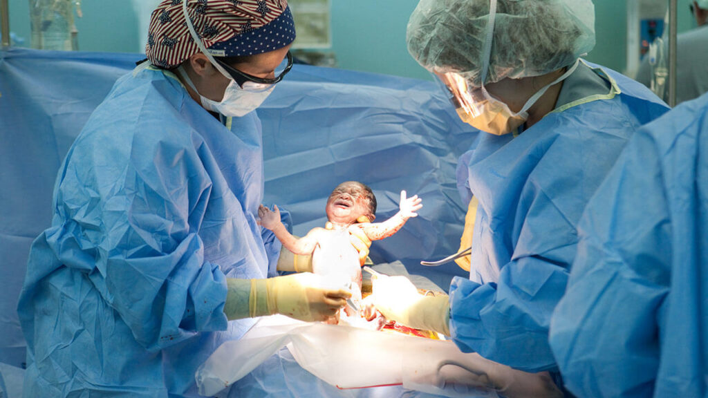 مزایا و معایب زایمان سزارین