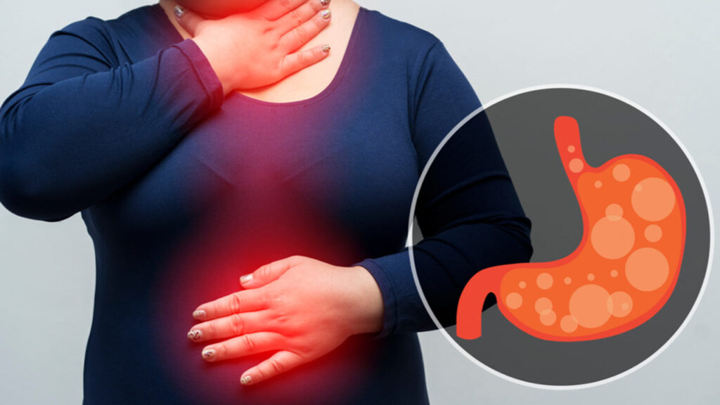 درمان ترش کردن معده در خانه