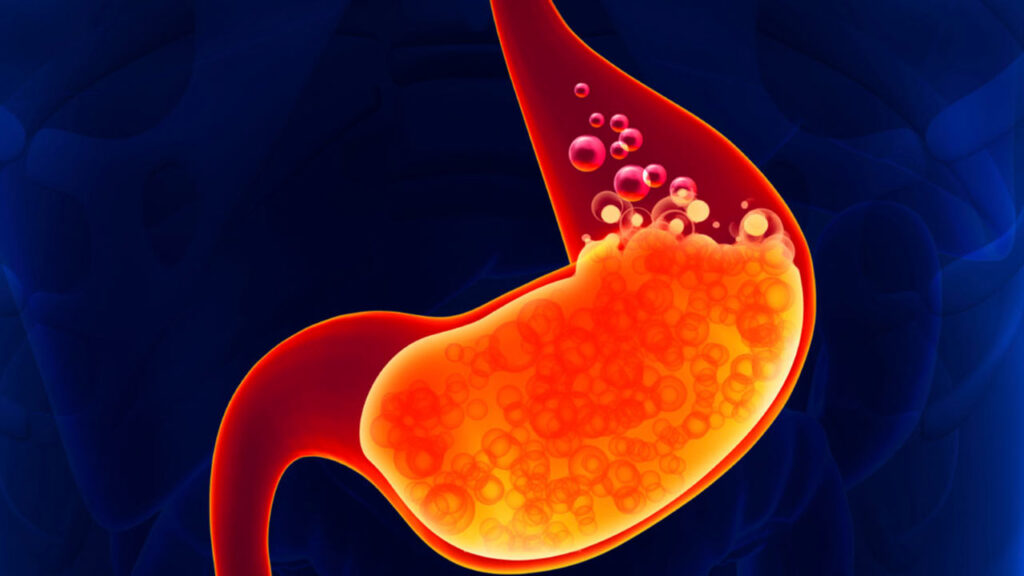 علائم ترش کردن معده و درمان آن در خانه