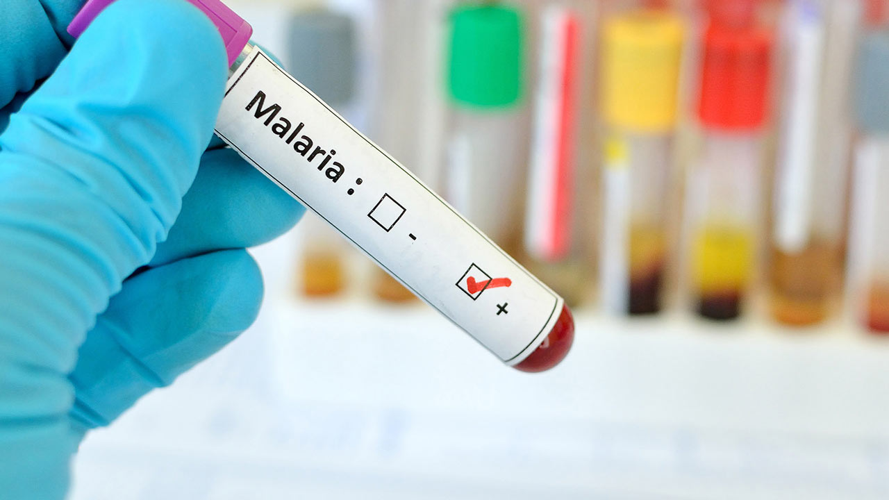 درمان بیماری مالاریا
