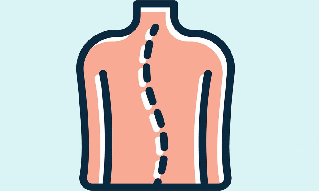 قوز ستون فقرات