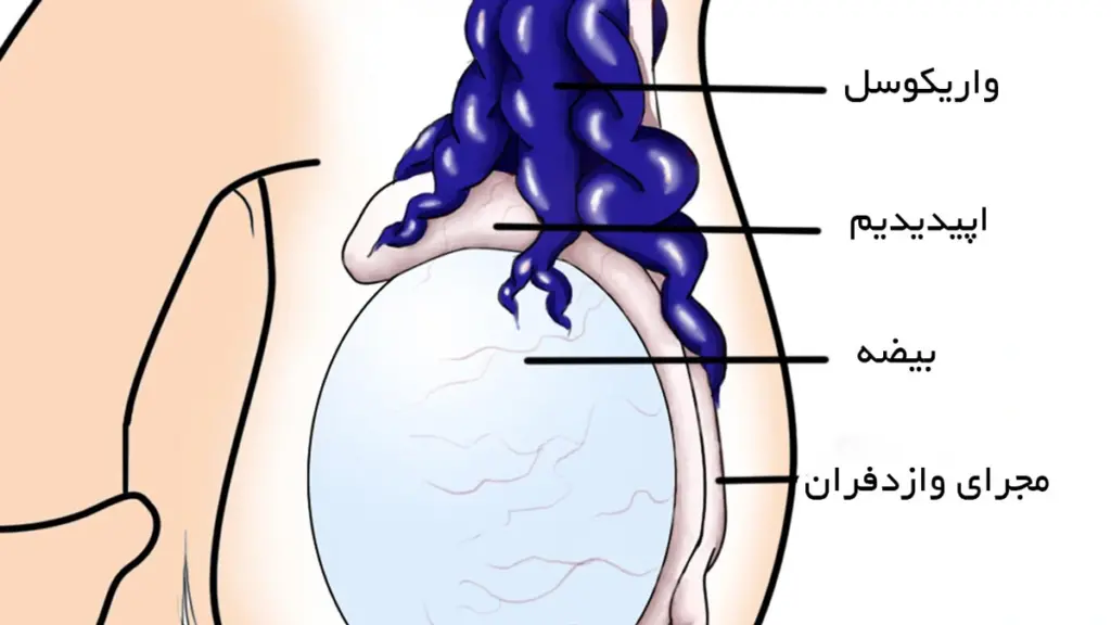 ساختار بیضه و واریکوسل
