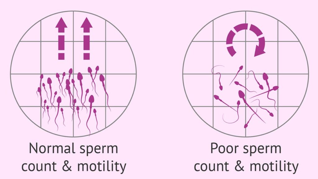 اسپرم ضعیف و کم مردان