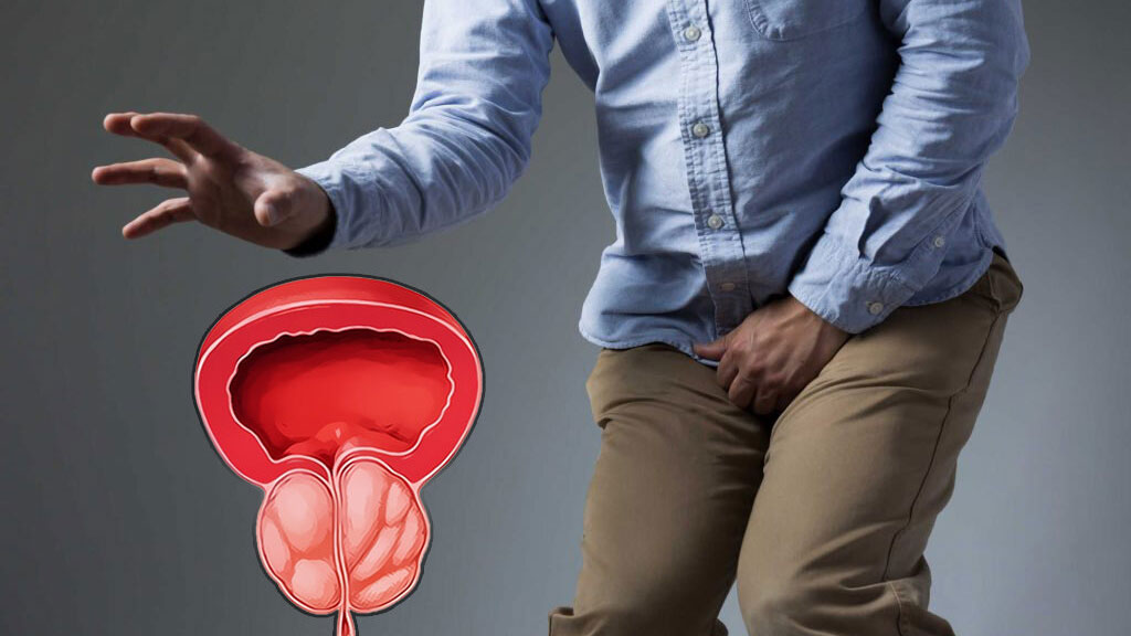 عوارض التهاب پروستات