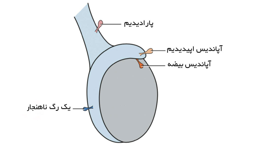 آپاندیس بیضه چیست